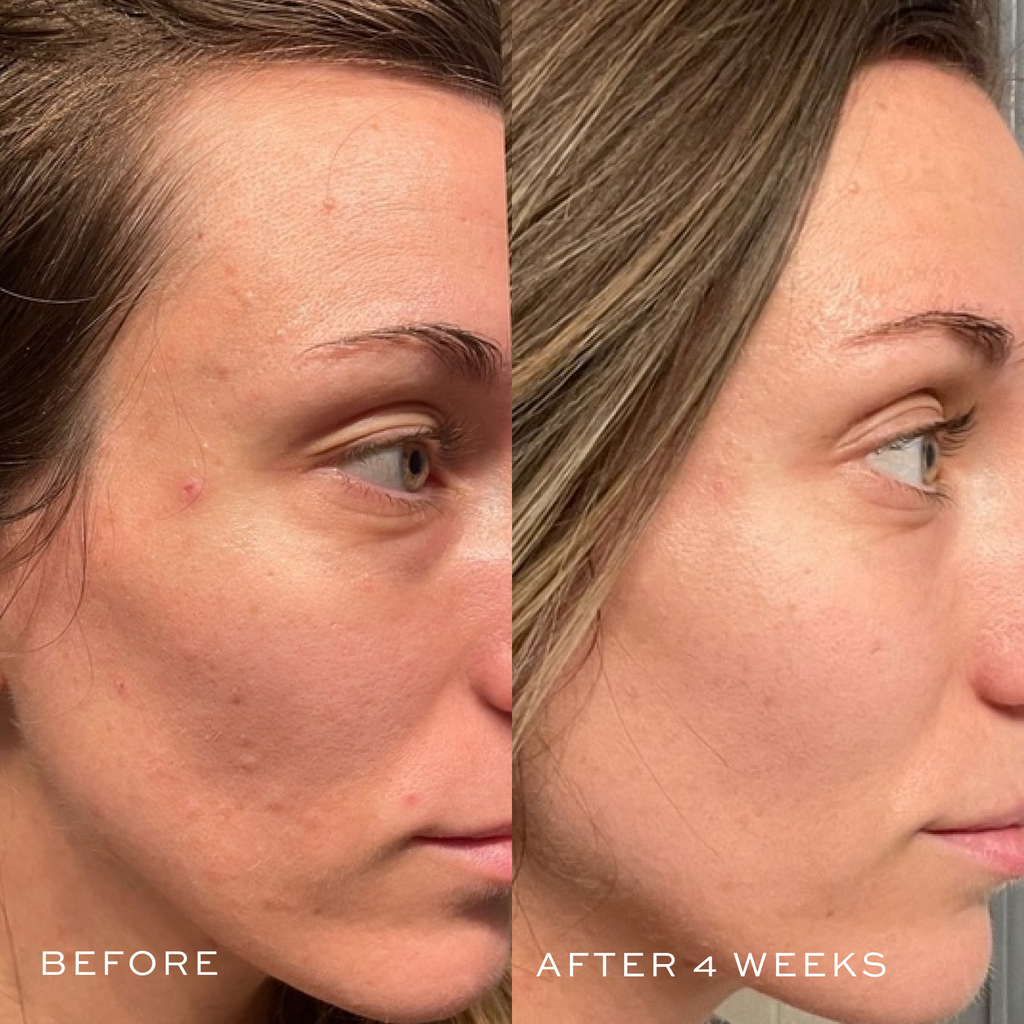Jumbo Hyaluronic Acid Serum